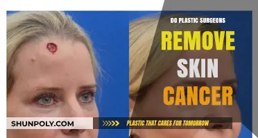 Do Plastic Surgeons Remove Skin Cancer? Expert Insights and Procedures