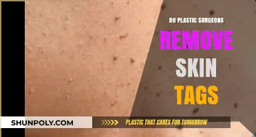 Can Plastic Surgeons Safely Remove Skin Tags? Expert Insights