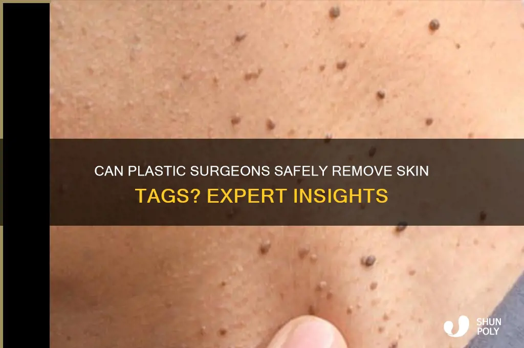 do plastic surgeons remove skin tags