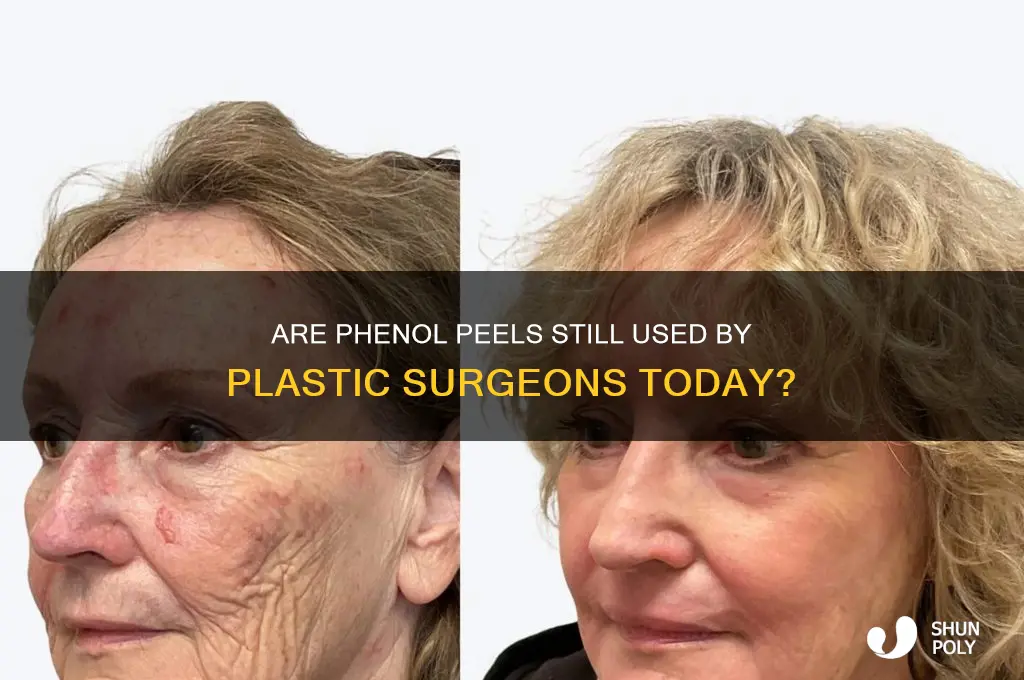 do plastic surgeons still do phenol peels