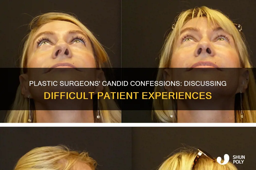 do plastic surgeons talk about bad patients