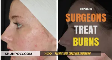 Do Plastic Surgeons Treat Burns? Expert Insights and Care Explained