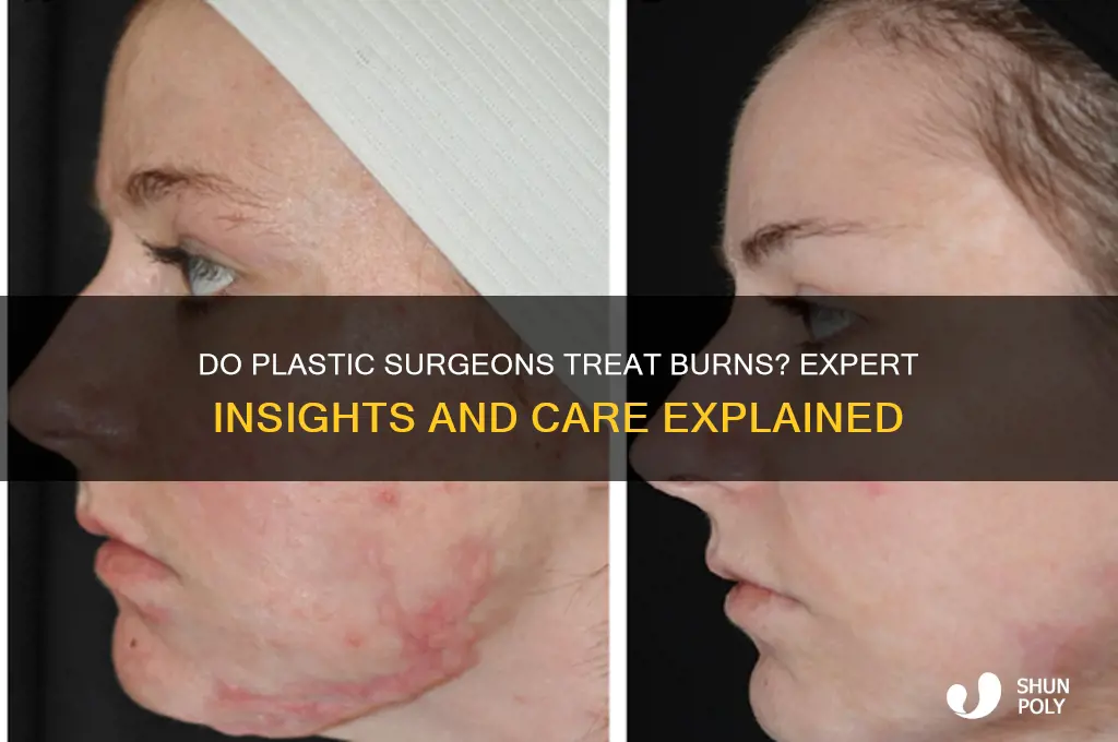 do plastic surgeons treat burns