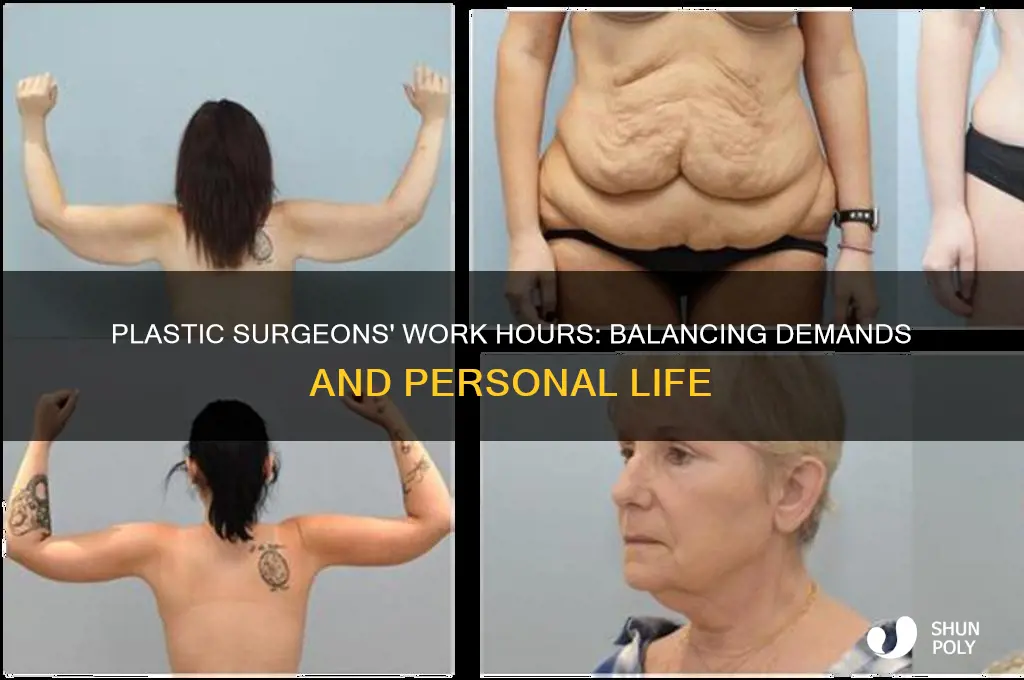 do plastic surgeons work long hours
