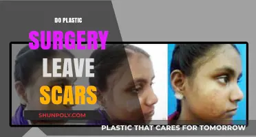 Does Plastic Surgery Leave Scars? Understanding Post-Op Marks and Healing