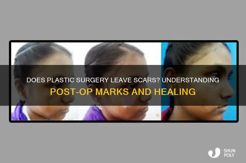 do plastic surgery leave scars