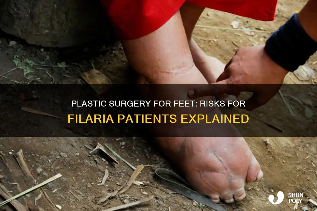 do plastic surgery of feets harmful for filaria patent