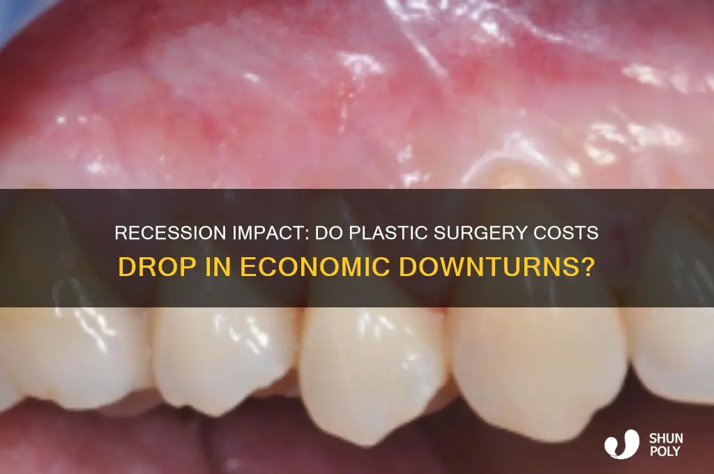 do plastic surgery prices go down during recession