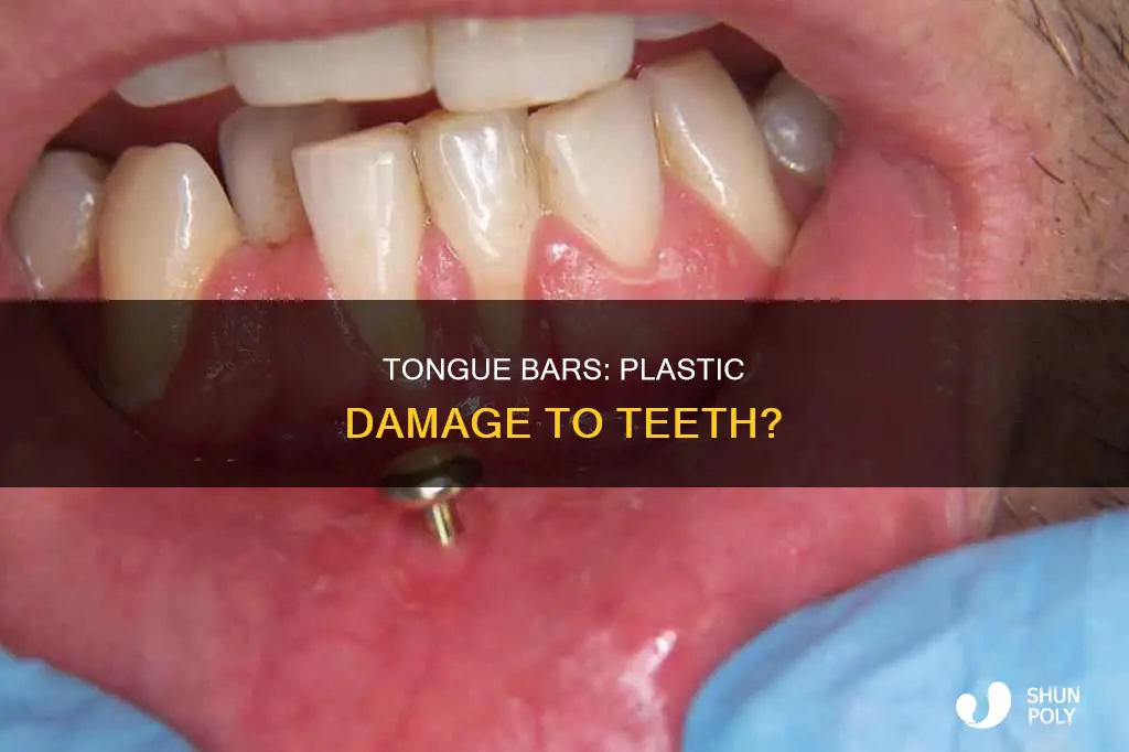 do plastic tongue bars damage teeth