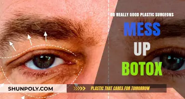 Can Top Plastic Surgeons Botch Botox? Unveiling the Truth