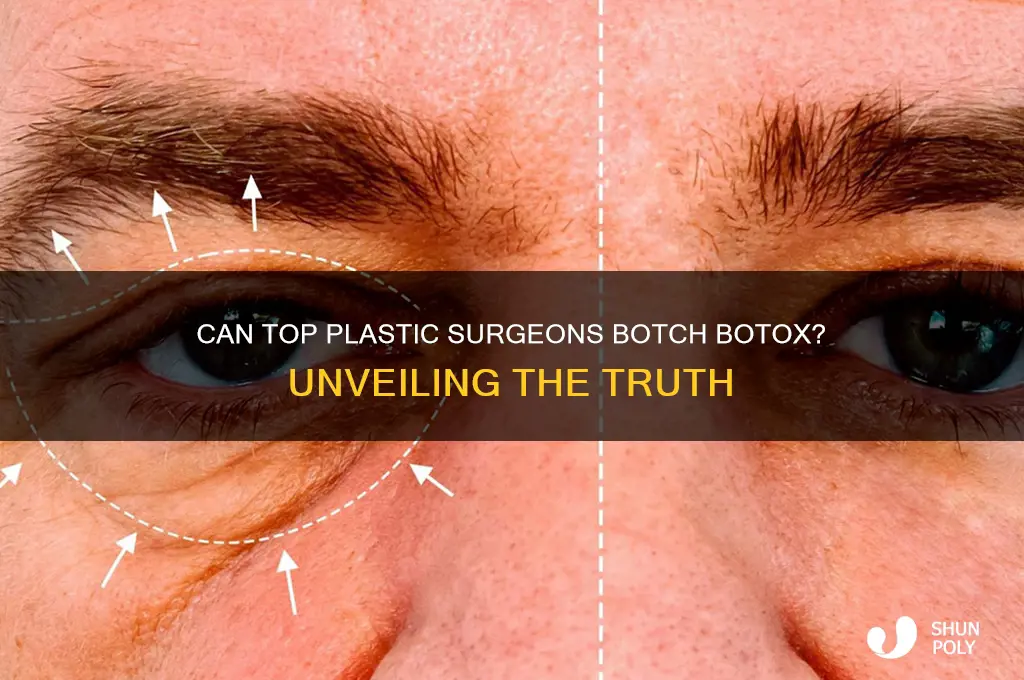 do really good plastic surgeons mess up botox