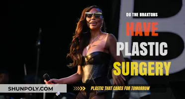 Braxton Sisters' Plastic Surgery: Fact-Checking Their Transformation Rumors