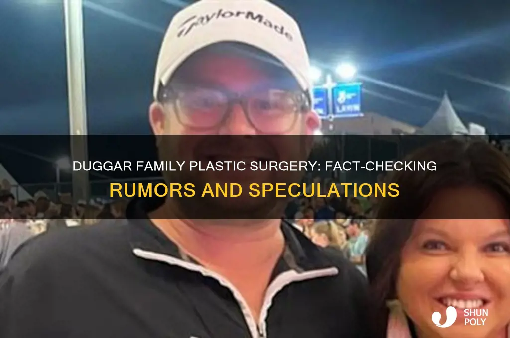 do the duggars get plastic surgery