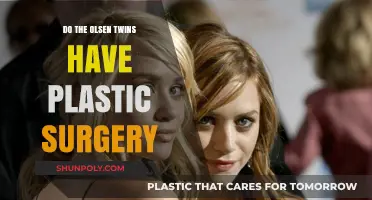 Olsen Twins Plastic Surgery: Fact or Fiction? Unveiling the Truth