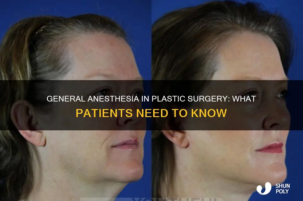 do they use general anesthesia for plastic surgery
