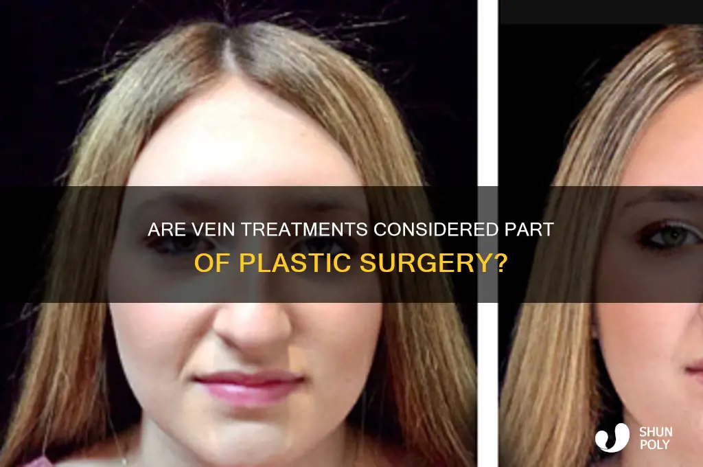 do vein treatments come under plastic surgery