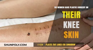 Knee Skin Plastic Surgery: Exploring Women's Cosmetic Procedures and Trends