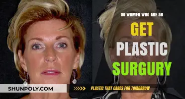 Aging Gracefully or Enhancing Beauty: Plastic Surgery at 58?