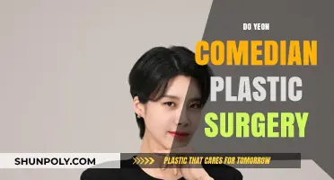 Do Yeon's Comedy Journey: Plastic Surgery Speculations and Truths
