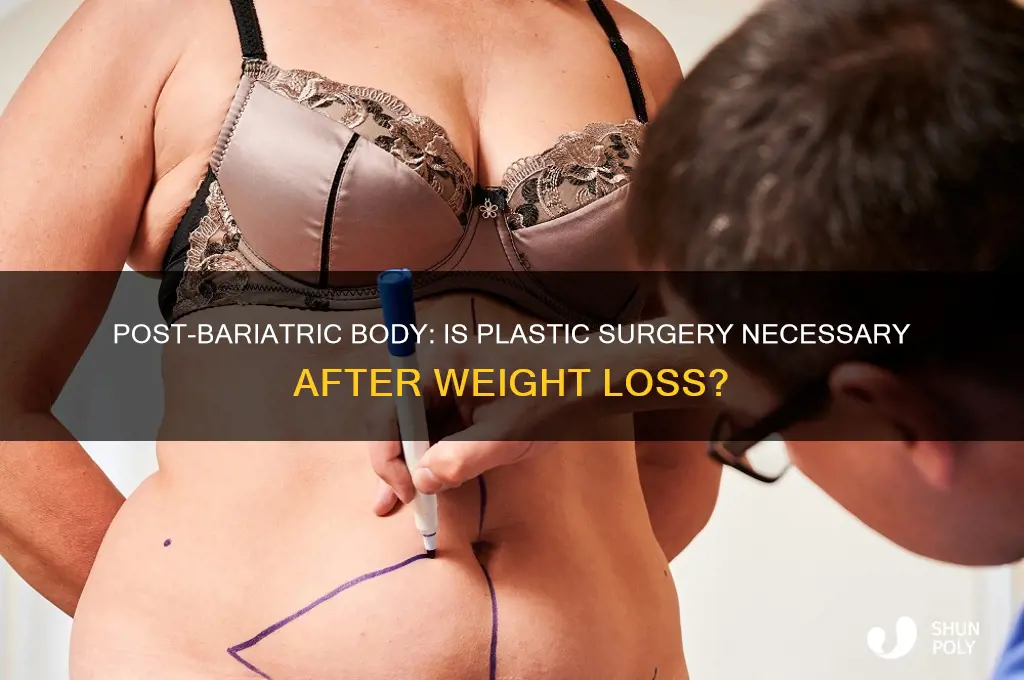do you always need plastic surgery after weight loss surgery