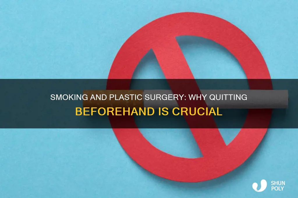 do you have to quit smoking before plastic surgery