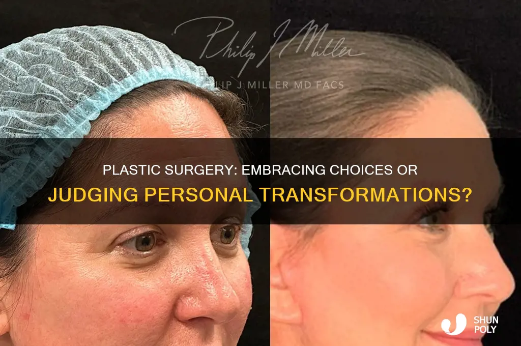 do you look down on plastic surgery