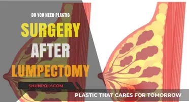 Considering Plastic Surgery After Lumpectomy? What You Need to Know