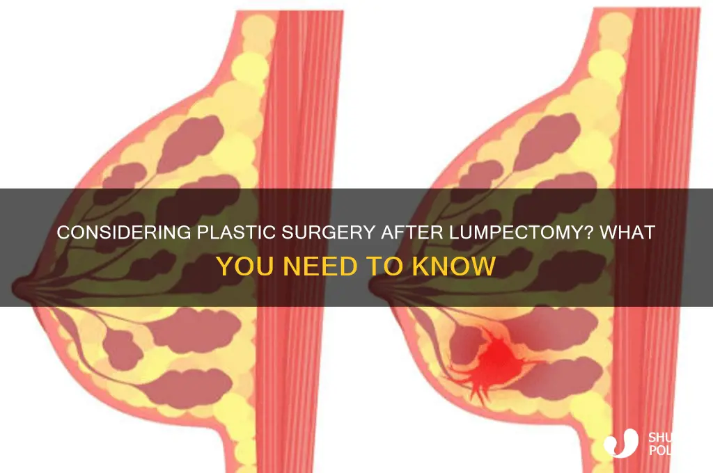 do you need plastic surgery after lumpectomy