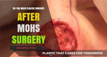 Post-Mohs Surgery: Is Plastic Surgery Necessary for Optimal Healing?