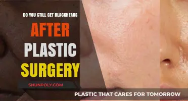 Post-Plastic Surgery Skincare: Why Blackheads Persist and How to Prevent Them
