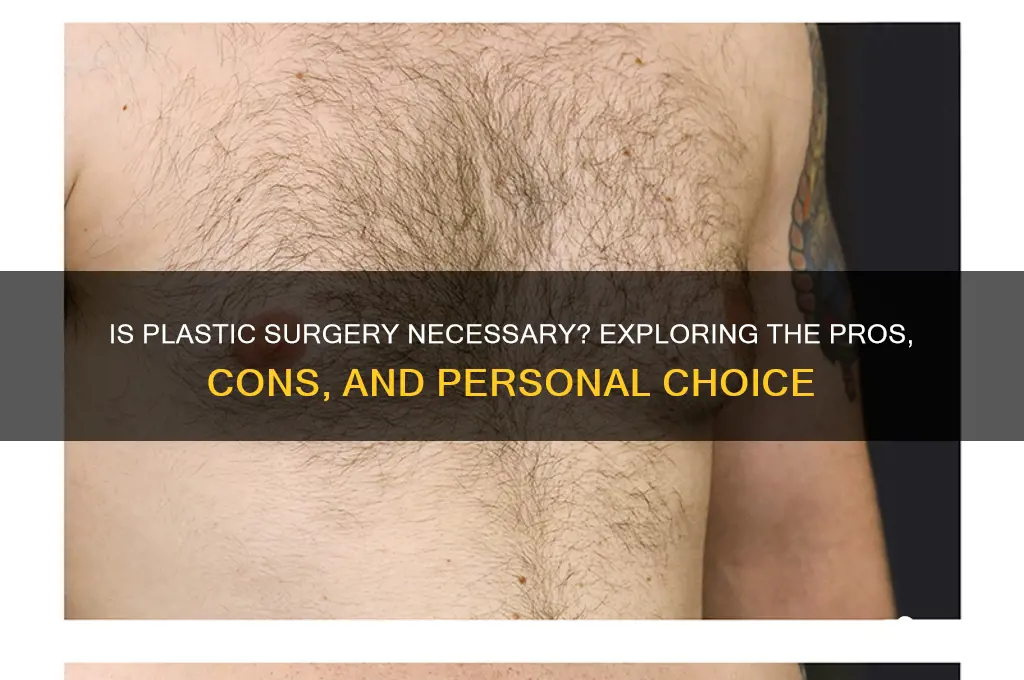do you think plastic surgery is necessary