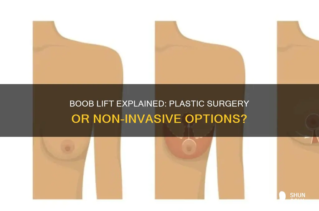 does a boob lift require plastic surgery