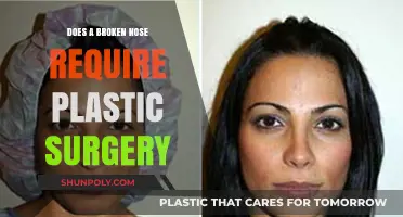 Broken Nose Repair: When Is Plastic Surgery Necessary for Healing?