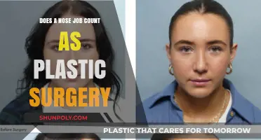Is a Nose Job Plastic Surgery? Understanding Rhinoplasty Procedures