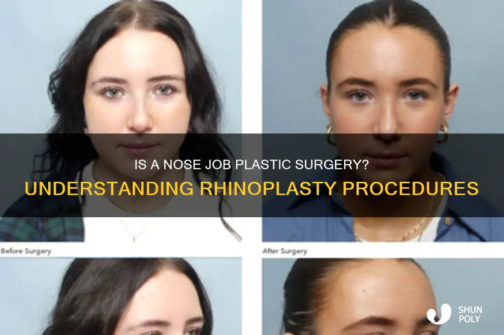 does a nose job count as plastic surgery