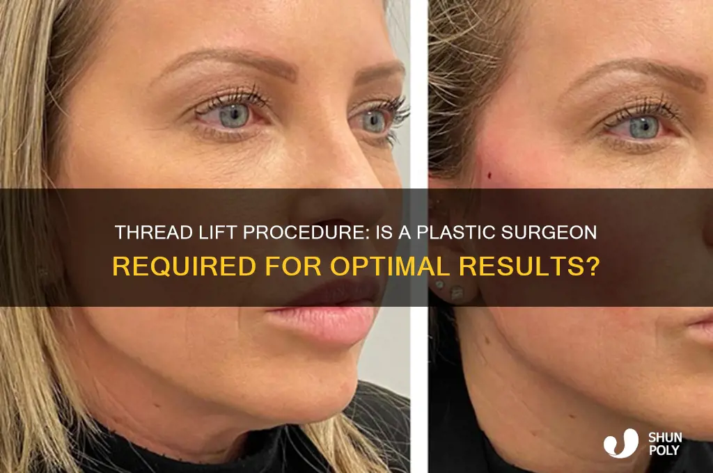 does a plastic surgeon have to do a thread instlift
