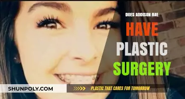 Addison Rae Plastic Surgery: Fact-Checking Rumors and Speculations