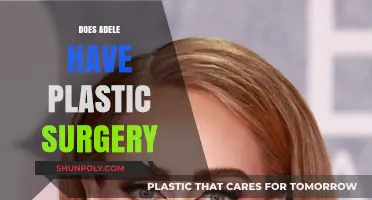 Adele's Transformation: Plastic Surgery Speculations and the Truth Behind It