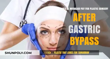 Does Medicaid Cover Plastic Surgery Post-Gastric Bypass? What to Know