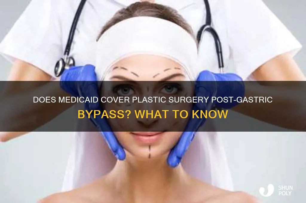 does al medicaid pay for plastic surgery after gastric bypass