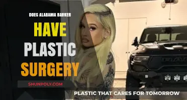 Alabama Barker Plastic Surgery: Fact-Checking the Transformation Rumors