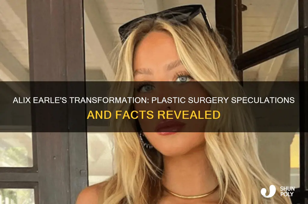 does alix earle have plastic surgery