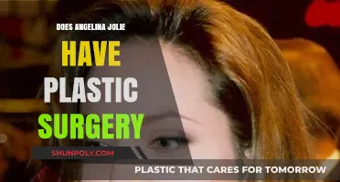 Angelina Jolie's Transformation: Plastic Surgery Rumors and Facts Revealed