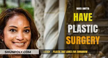 Anitta's Transformation: Unveiling the Truth About Her Plastic Surgery