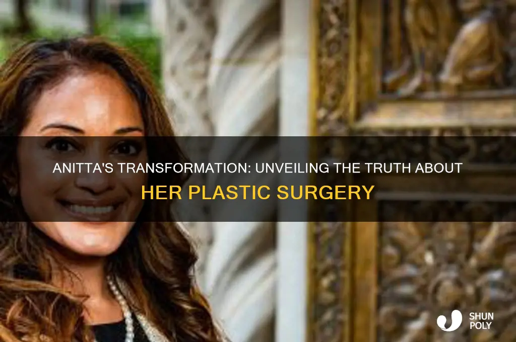 does anitta have plastic surgery