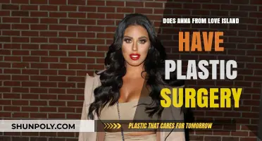 Anna from Love Island: Plastic Surgery Rumors Explored