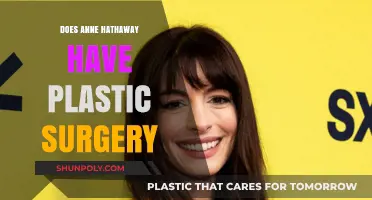 Anne Hathaway's Transformation: Plastic Surgery Rumors Explored and Debunked