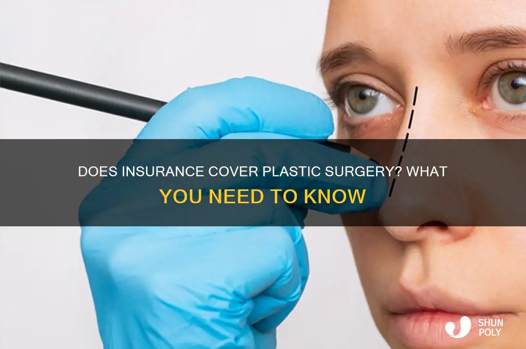 does any insurance cover plastic surgery