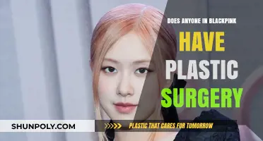 Blackpink Plastic Surgery: Unveiling the Truth Behind the K-Pop Phenomenon