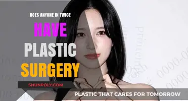 TWICE Members and Plastic Surgery: Fact-Checking the Rumors